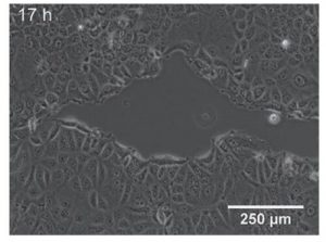 創傷治癒アッセイにおけるギャップ閉鎖のライブイメージング