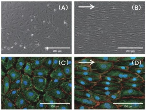 肺血管内皮細胞(HPMEC)位相差顕微鏡および蛍光顕微鏡検査