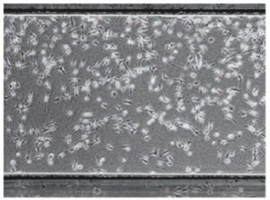 走化性アッセイ中の細胞遊走のライブ可視化