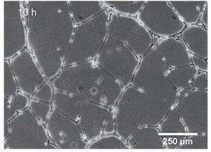 内皮細胞管形成のライブ顕微鏡観察