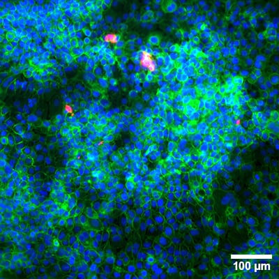 マイクロプレート 24ウェル メンブレンインサート用フレーム付_アプリケーション例_1